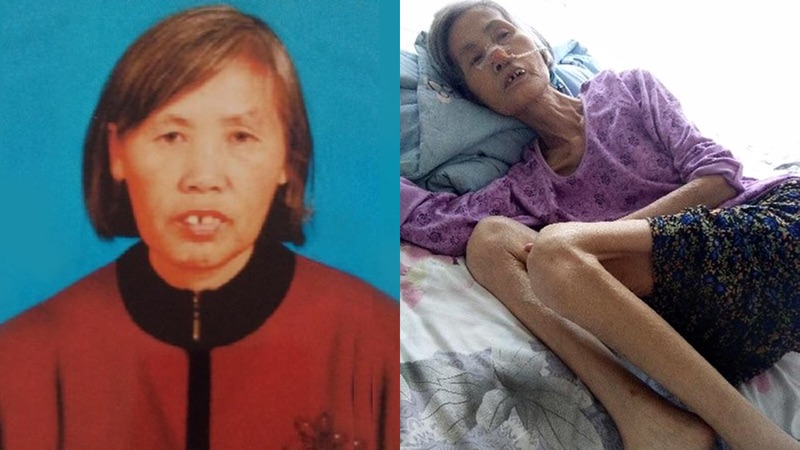 Teško bolesna žena zatvorena do isteka kazne, preminula 12 dana nakon puštanja na slobodu