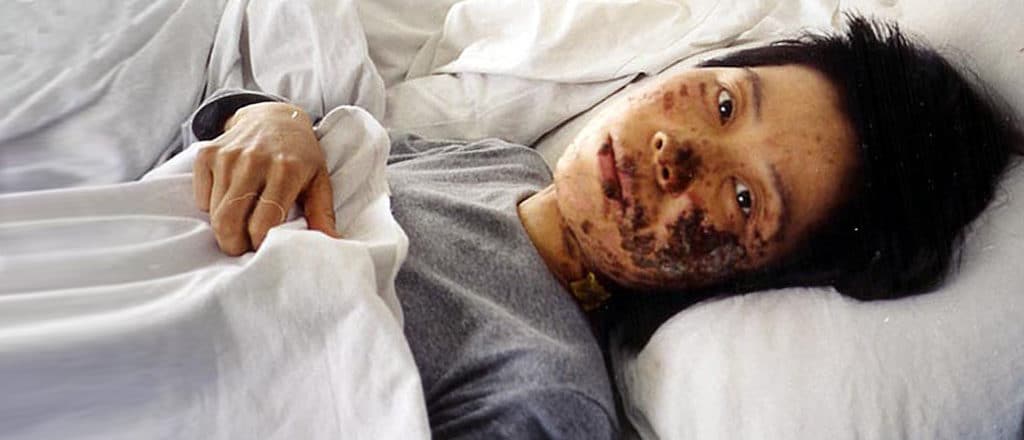 Gao Rongrong after electric-baton torture