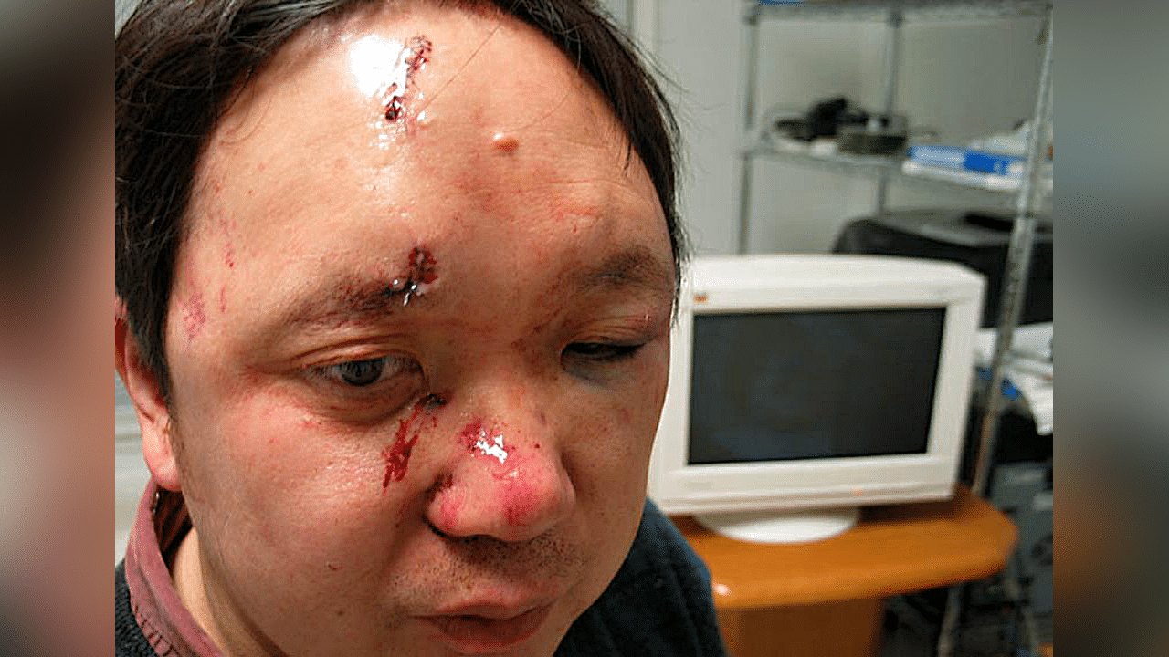 Peter Yuan Li, Atlanta (2006)